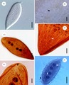 Protoopalina pingi (Opalinea)