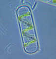 하나의 Spirogyra 세포