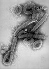 Abb. 1: EM-Aufnahme von Virionen des Marburg-Virus.