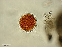 Filopodios (proyecciones casi transparentes) en un cercozoo