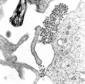 Eletromicrografia de vírus da dengue (Família: Flaviviridae).