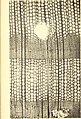 Image 27A thin transverse section showing the internal structure of conifer wood (from Conifer)