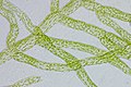 Protonemazellen des Laubmooses Physcomitrella patens