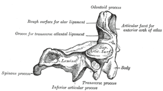 제2목뼈, 중쇠뼈(축추, axis). 옆모습
