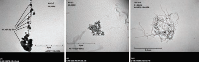 Three greyscale microscope images arranged horizontally. The left two show agglomerations of black spots on a grey background, while the right one shows a mass of tangled fibers.