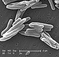 Immagine da microscopio elettronico a scansione di M. tubercolosis.