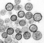 Virus Hanta (Hantaviridae)