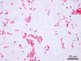 Escherichia coli da ordem "Enterobacteriales".