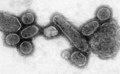 Chʼosh doo yitʼínii, "Virus" wolyéhígíí. 1918 influenza virus éélkid.