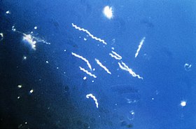 Borrelia burgdorferi