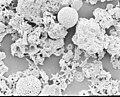 Sediment sample with microfossils