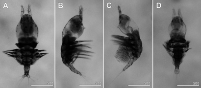 Monstrillopsis longilobata microphotographs of females.png