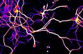 Axons, Alzheimers