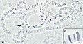 Polytene chromosomes