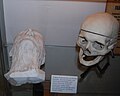 Masque mortuaire et crâne de Waldeyer.