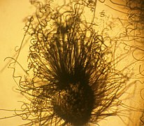 Microphoto Chaetomium globosum.jpg