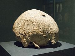 Trepaned skull, prehistoric times, City of Prague Museum, 175924.jpg