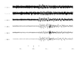 Seismic noise (3/2)