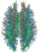 White Matter Connections Obtained with MRI Tractography.png